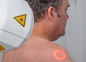 Low Level Laser Therapy Low Level Laser Therapy